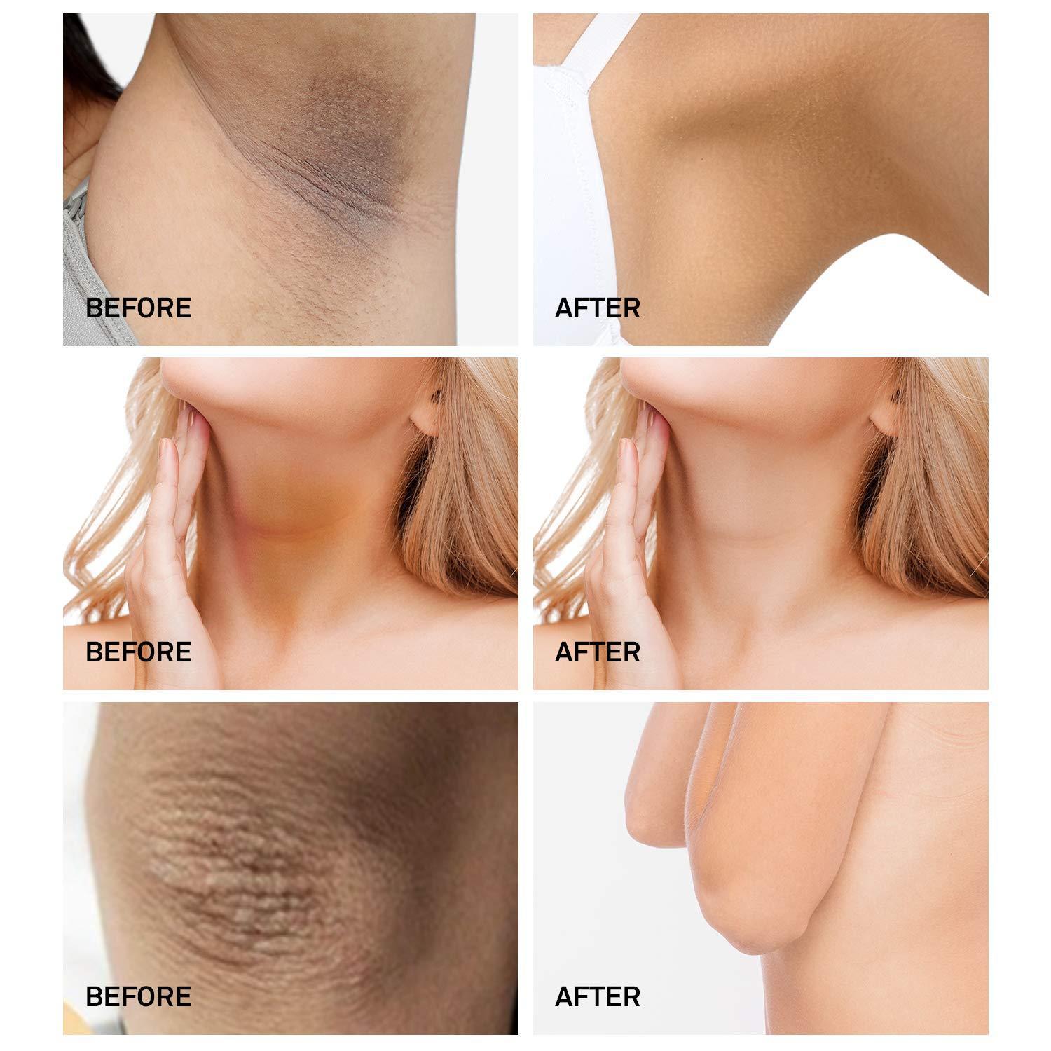 VOVA whitening cream for sensitive areas 30ml