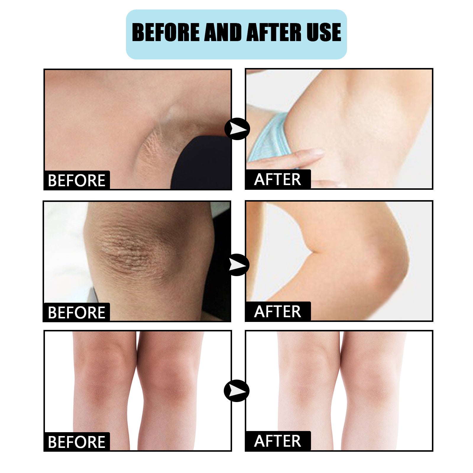 Brightening Cream, Moisturizing Knee Elbow Concealer Moisturizing Delicate And Brightening Body Lotion