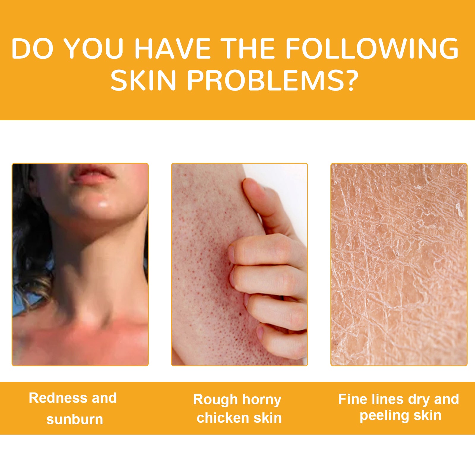 Vitamin C Skin Brightening Cream, Repair Dry Dull Skin Hydrating Moisturizing Smooth Skin Brightening Cream