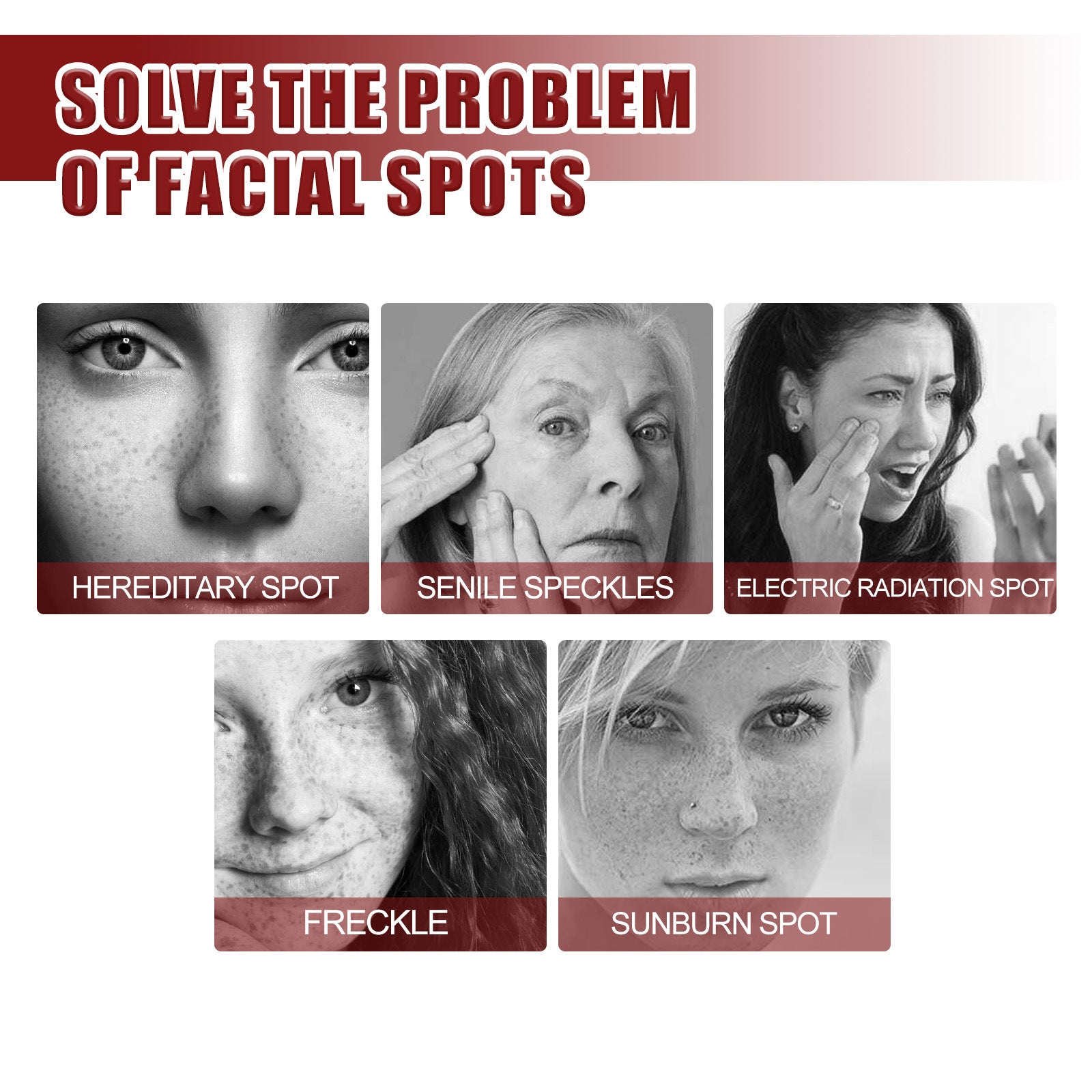 Brightening Cream For Blemish Reduction, Brightening Skin, Moisturizing Beauty And Lightening Face Cream For Yellow Spots