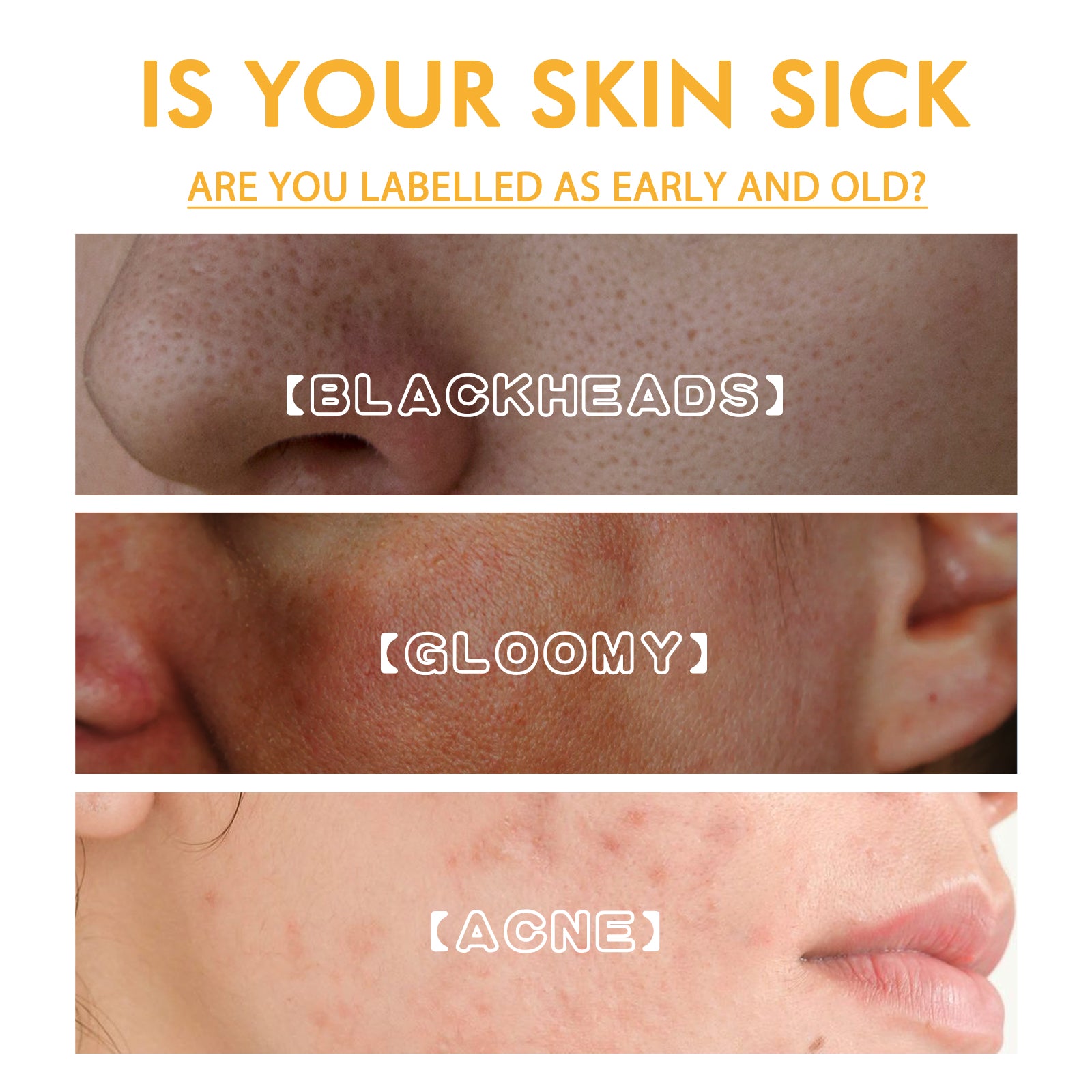 Brightening Peel Mask, Whitening Skin, Removing Melanin Spots, Blackheads, Acne, Anti-Wrinkle And Firming Skin