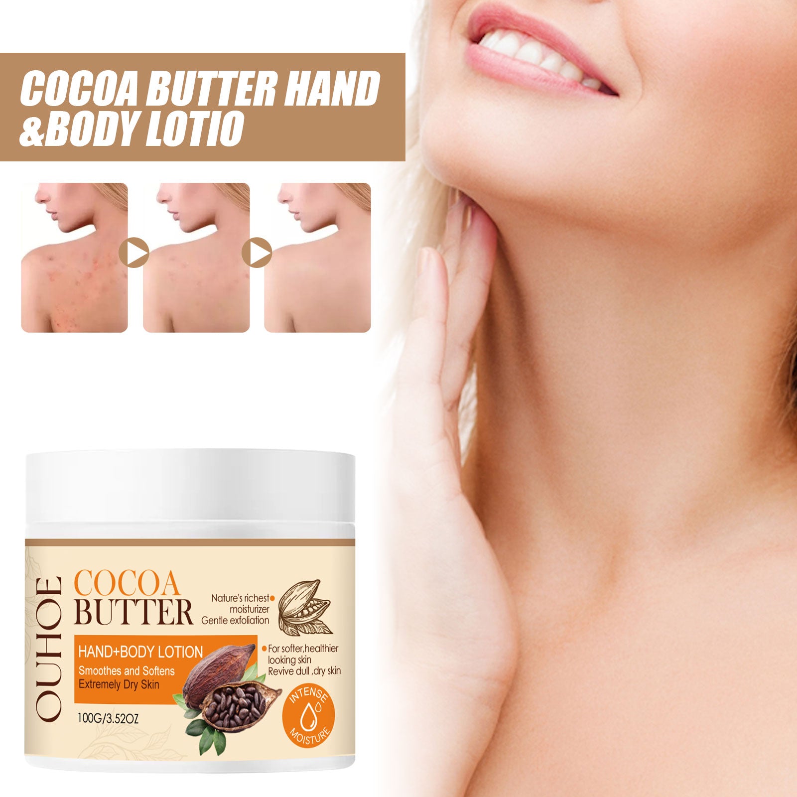 Cacao Body Lotion, Lightening Acne Mark Dark Hydrating Whitening Body Lotion