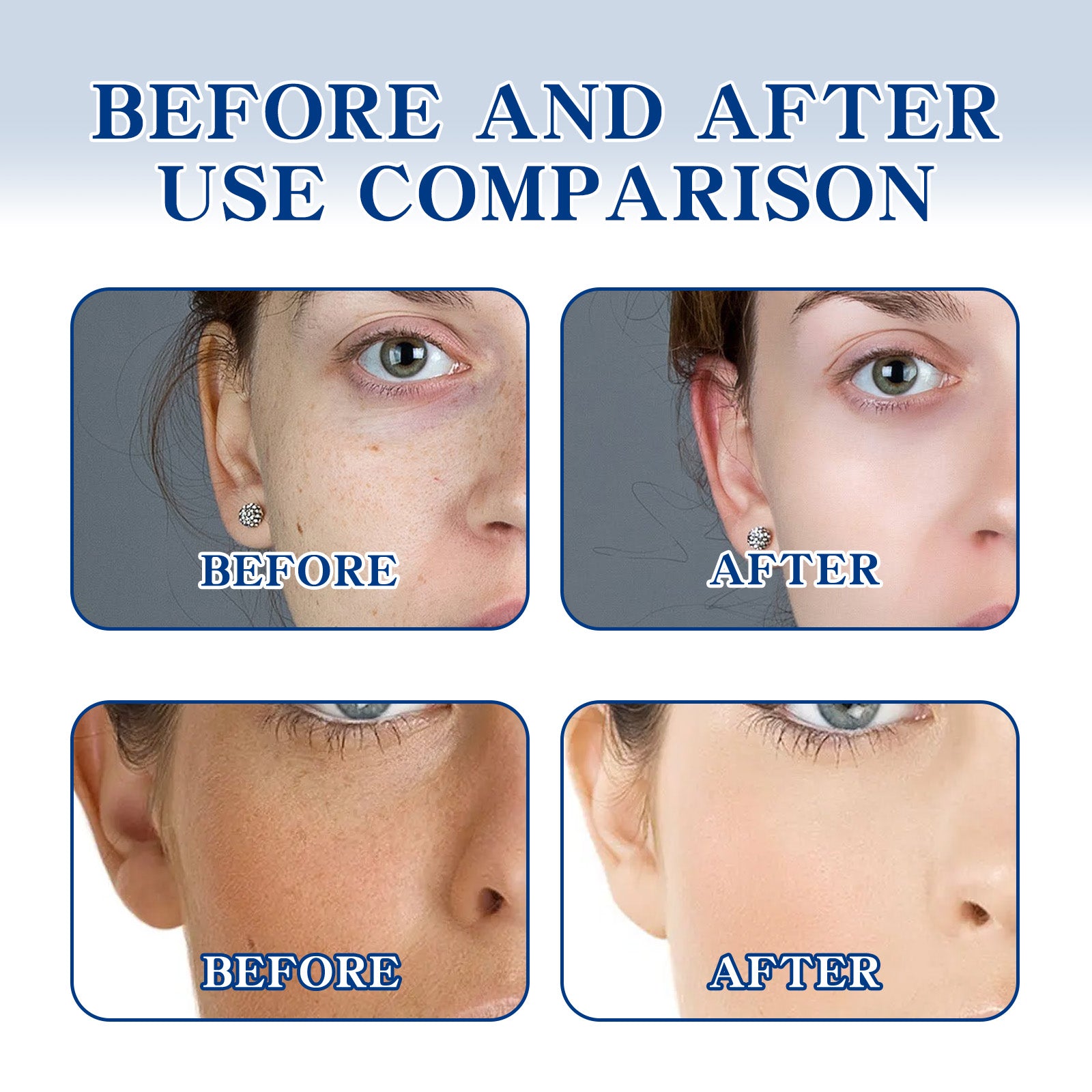 Ouhoe Brightening Cream Brightening Complexion Lightening Facial Spots Hydrating Moisturizing Firming And Tender Skin Cream