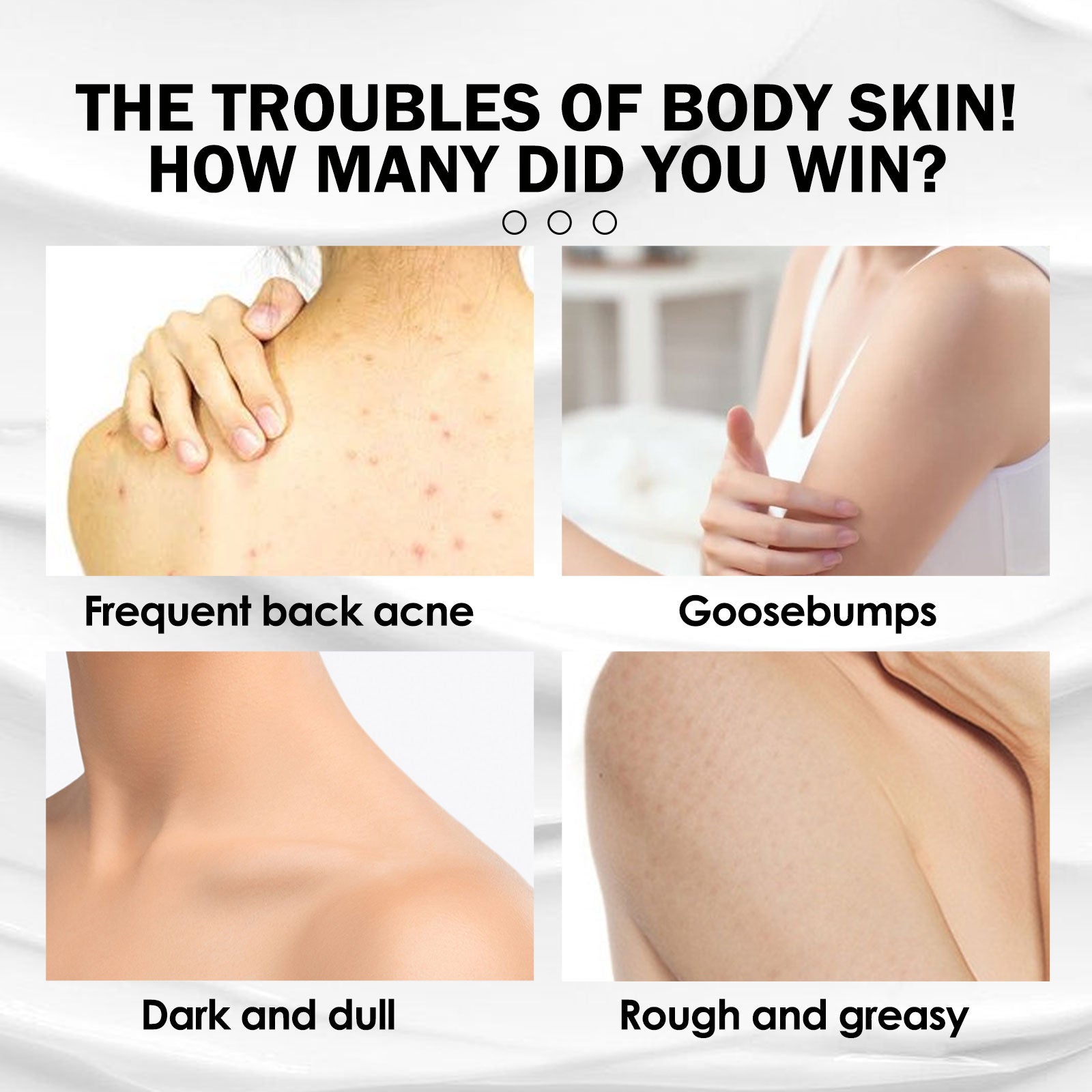 Brightening And Moisturizing Body Lotion, Repair Chicken Skin, Prevent Dry, Tender And Smooth Skin, Whitening And Beautifying Skin